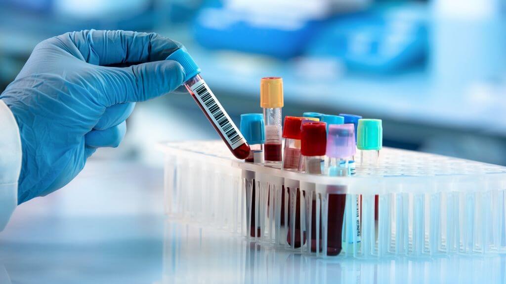 Diagnostic tests being sponsored